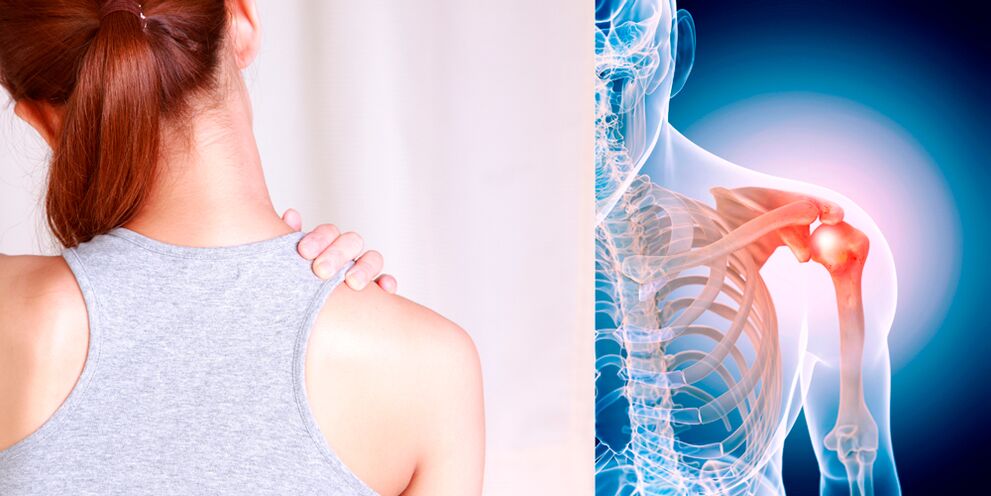 The development of osteoarthritis of the shoulder gradually causes constant pain