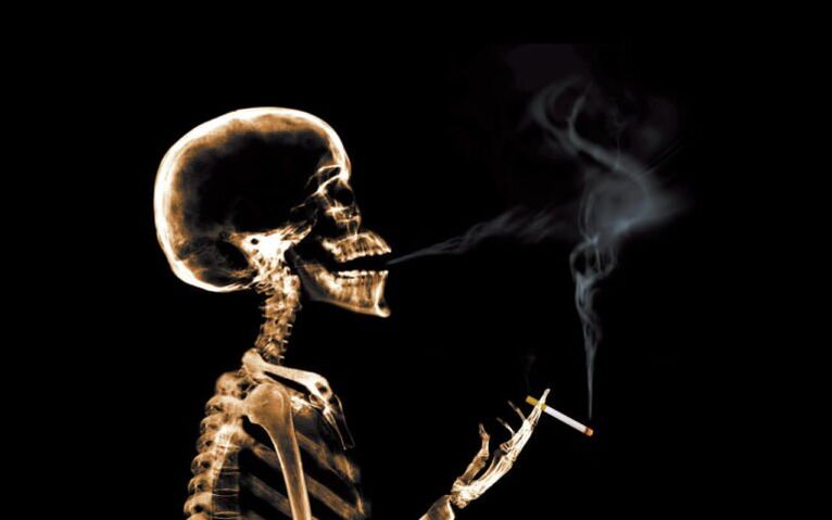 Smoking as a cause of back pain in the shoulder blade area