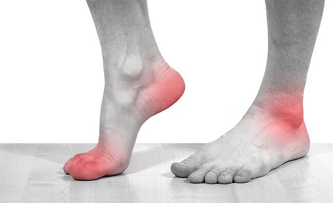 Pain in the joints of the ankle with arthrosis