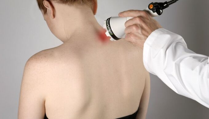Laser therapy in cervical osteochondrosis